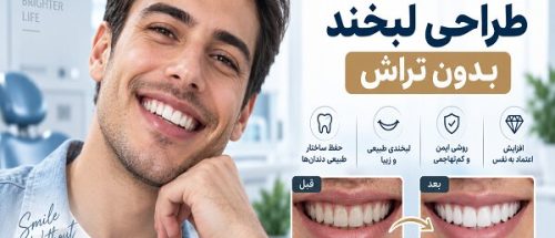 بازسازی لبخند پس از ازدست‌دادن دندان؛ از ایمپلنت تا طراحی لبخند_6aa8f66142b13.jpeg