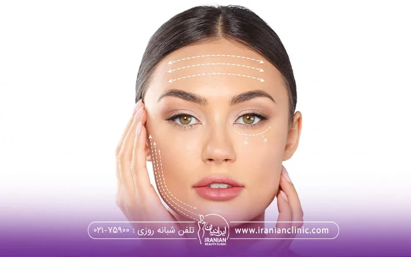 خانمی که به رو به رو نگاه میکند و با یکدست یک سمت صورت پایین تر از گوش را گفته و با دست دیگر بالاتر از گوشش را گرفته است و روی صورتش خط هایی نقطه چین در جهات مختلف کشیده شده است