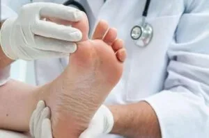 آنچه باید درباره «درد پاشنه» بدانیم