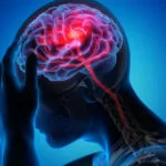آیا مادر بودن از سکته مغزی پیشگیری می‌کند