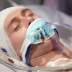 ضربه به سر ممکن است سلامت روده را مختل کند